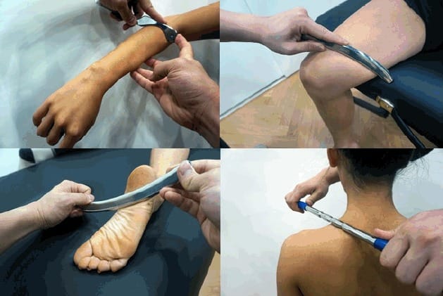 IASTM Therapy